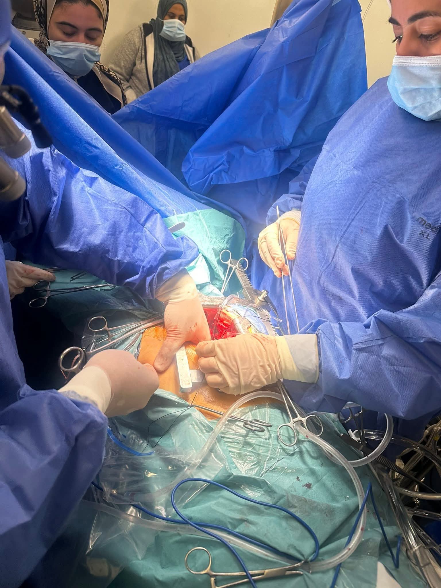 إنجاز يضاف لسجل نجاحاتها| بدون «شق عظمة القص».. نجاح جراحة قلب مفتوح متطورة بمستشفيات جامعة بنها